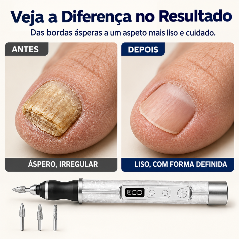 Lima de Unhas Elétrica e Removedor de Calosidades