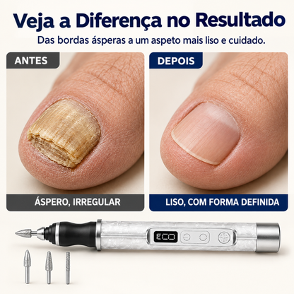Lima de Unhas Elétrica e Removedor de Calosidades