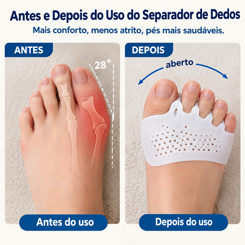 Separadores de Dedos dos Pés