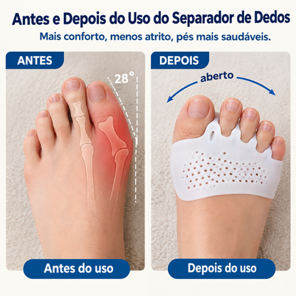Separadores de Dedos dos Pés